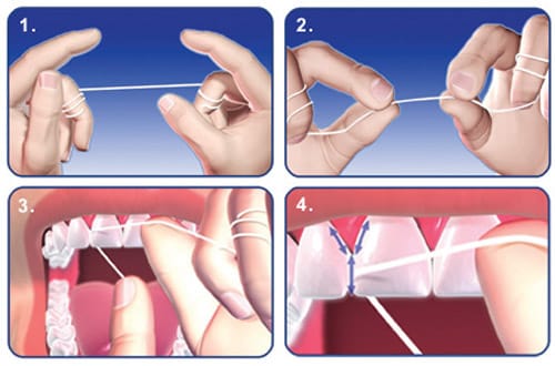 Cara Floss Gigi Yang Betul Untuk Gusi Sihat 1 How to floss your teeth 3