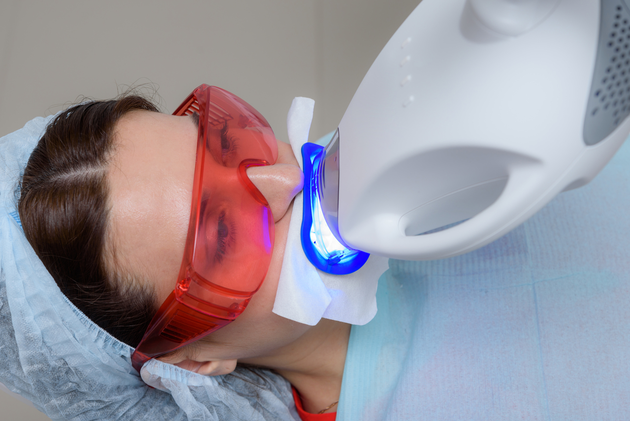 In-office teeth whitening procedure