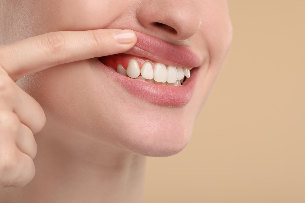 Woman lifting her lip to show her teeth