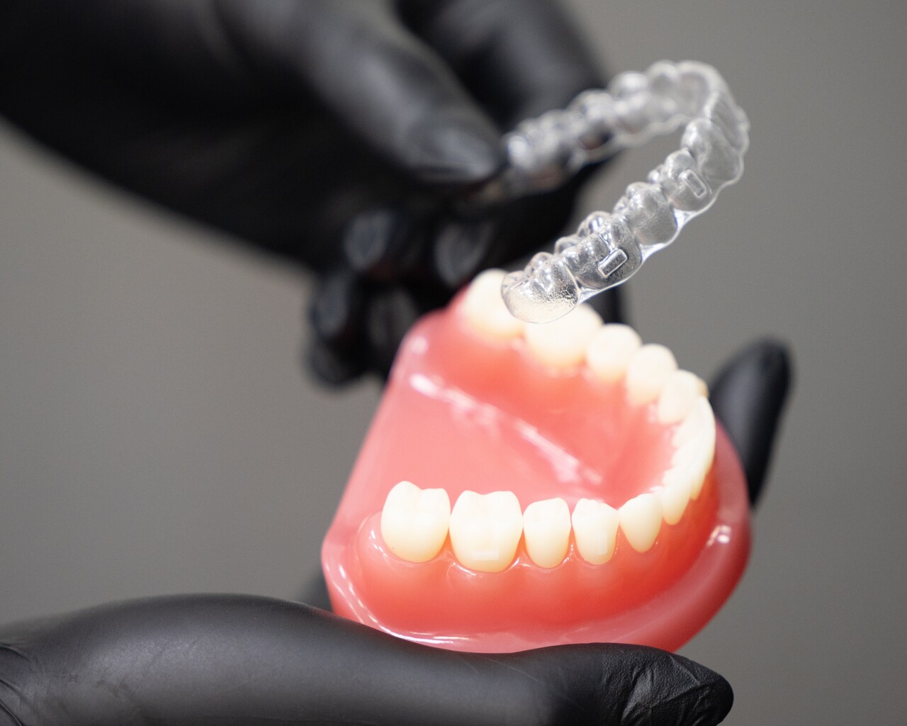 Aligners with teeth model